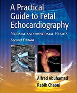 Echocardiography Board Review 500 Multiple Choice Questions with Discussion 2nd Edition