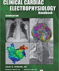 Clinical Cardiac Electrophysiology Handbook 2nd Edition