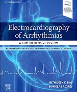 Electrocardiography of Arrhythmias A Comprehensive Review 2nd Edition