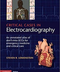 Critical Cases in Electrocardiography An Annotated Atlas of Dont Miss ECGs for Emergency Medicine and Critical Care