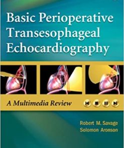Basic Perioperative Transesophageal Echocardiography A Multimedia Review