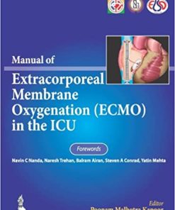 Manual of Extracorporeal Membrane Oxygenation Ecmo in the ICU