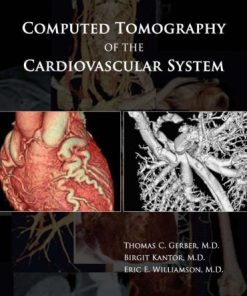 Computed Tomography of the Cardiovascular System