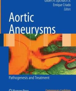 Aortic Aneurysms Pathogenesis and Treatment