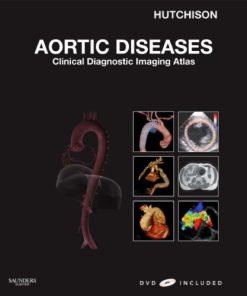Aortic Diseases Clinical Diagnostic Imaging Atlas