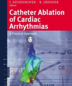 Catheter Ablation of Cardiac Arrhythmias A Practical Approach