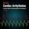 Bennetts Cardiac Arrhythmias Practical Notes on Interpretation and Treatment 8th Edition
