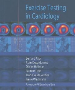 Exercise Testing in Cardiology