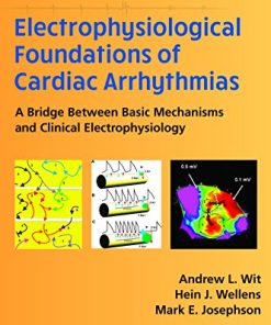 Electrophysiological Foundations of Cardiac Arrhythmias A Bridge Between Basic Mechanisms and Clinical Electrophysiology