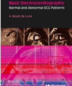Basic Electrocardiography Normal and Abnormal ECG Patterns deLuna