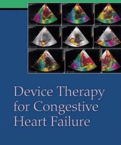 Device Therapy for Congestive Heart Failure