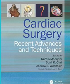 Cardiac Surgery Recent Advances and Techniques