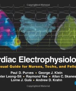 Cardiac Electrophysiology A Visual Guide for Nurses Techs and Fellows