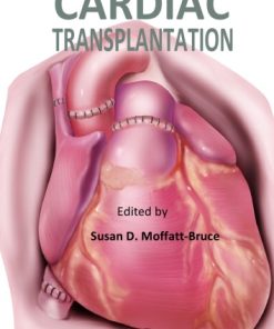 Cardiac Transplantation