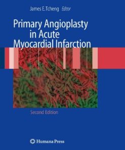 Primary Angioplasty in Acute Myocardial Infarction