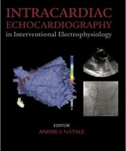 Intracardiac Echocardiography in Interventional Electrophysiology