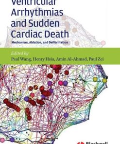 Ventricular Arrhythmias and Sudden Cardiac Death Mechanism Ablation and Defibrillation