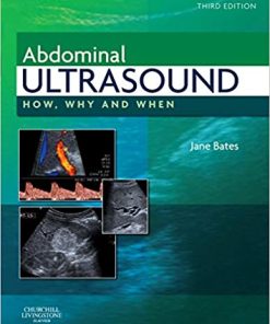 Abdominal Ultrasound How Why and When 3rd Edition