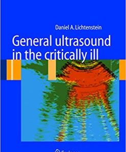 General ultrasound in the critically ill