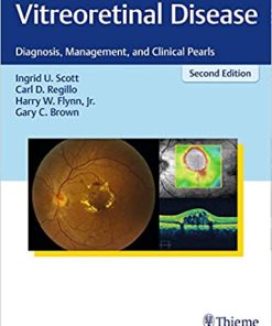 Vitreoretinal Disease Diagnosis Management and Clinical Pearls 2nd Edition