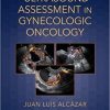 Ultrasound Assessment in Gynecologic Oncology