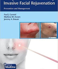 Complications in Minimally Invasive Facial Rejuvenation Prevention and Management