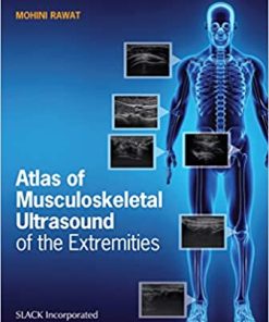 Atlas of Musculoskeletal Ultrasound of the Extremities