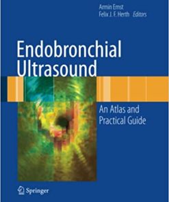 Endobronchial Ultrasound An Atlas and Practical Guide