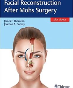 Facial Reconstruction After Mohs Surgery