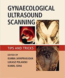 Gynaecological Ultrasound Scanning Tips and Tricks
