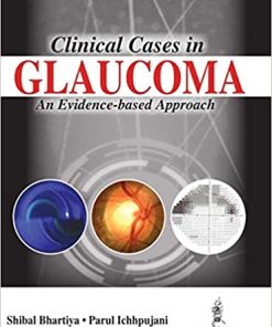 Clinical Cases in Glaucoma An Evidence Based Approach