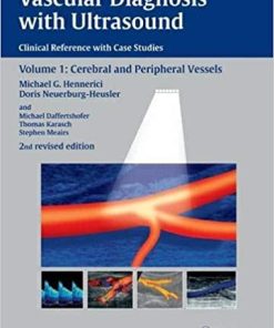 Vascular Diagnosis with Ultrasound Clinical Reference with Case Studies Volume 1 Cerebral and Peripheral Vessels