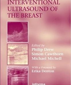 Interventional Ultrasound of the Breast