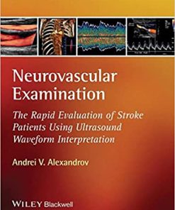 Neurovascular Examination The Rapid Evaluation of Stroke Patients Using Ultrasound Waveform Interpretation