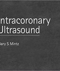 Intracoronary Ultrasound