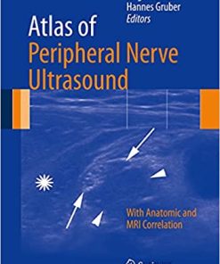 Atlas of Peripheral Nerve Ultrasound With Anatomic and MRI Correlation