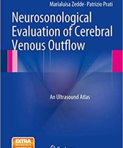 Neurosonological Evaluation of Cerebral Venous Outflow An Ultrasound Atlas