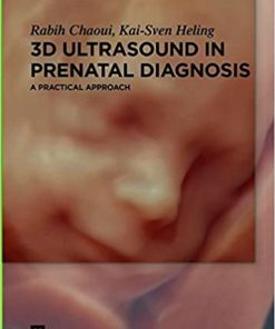 3D Ultrasound in Prenatal Diagnosis A Practical Approach