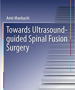 Towards Ultrasound Guided Spinal Fusion Surgery