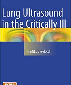 Lung Ultrasound in the Critically Ill The BLUE Protocol