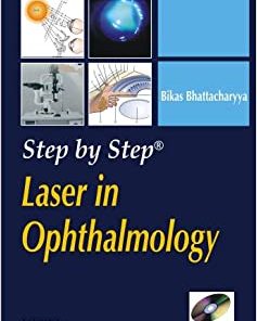 Step by Step Laser in Ophthalmology
