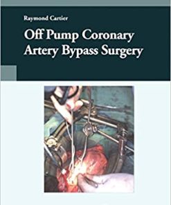 Off Pump Coronary Artery Bypass Surgery