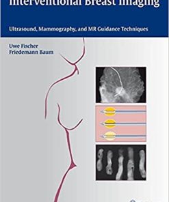 Interventional Breast Imaging Ultrasound Mammography and MR Guidance Techniques