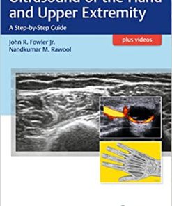 Ultrasound of the Hand and Upper Extremity A Step By Step Guide