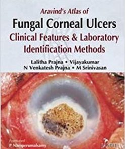 Aravinds Atlas Of Fungal Corneal Ulcers Clinical Features And Laboratory Identification Methods