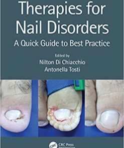 Therapies for Nail Disorders A Quick Guide to Best Practice