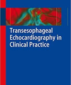 Transesophageal Echocardiography in Clinical Practice