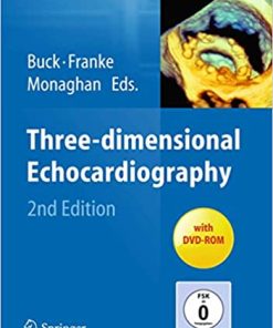 Three Dimensional Echocardiography 2nd Second