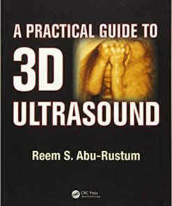 A Practical Guide to 3D Ultrasound