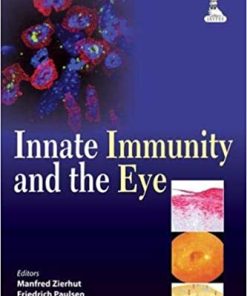 Innate Immunity and the Eye
